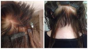 First the company updated its product pipeline page and added photos for each — wen hair care product lawsuit concludes in favor of customers. Garnier Olia Makes You Hair Fall Out And Will Be Classed As An Inconvenience By Garnier Every Two Weeks For Y Garnier Olia Hair Falling Out Fall Hair