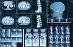 Metro imaging has been the model for outpatient imaging in the greater st. Ct Scan Near Me X Ray Near Me X Ray Consultants