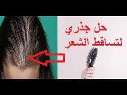 الحل النهائي لعلاج مشكلة تساقط الشعر مع الطريقة الأمثل لإزالة ندبات Hair Hair Straightener Beauty