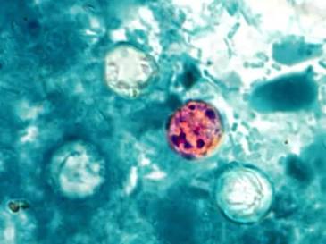 Parásito microscópico Cyclospora cayetanensis, generada por IA