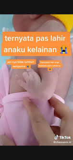 Ingin mengungkapkan kerinduan pada ibu tapi bingung merangkai kata? Konten Viral Ibu Hamil Tak Pernah Usg Dan Minum Vitamin Bayi Lahir Begini