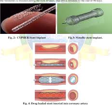 Pdf Implantable Drug Delivery Systems A Review On Parenteral Implants Semantic Scholar