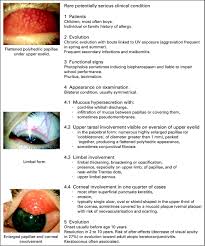 Image result for Vernal Conjunctivitis