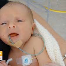 Baby survives after being born with no blood