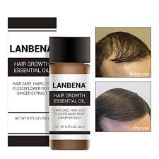 Tea tree oil is another great oil for reducing buildup of dead skin cells on the scalp which can cause hair loss, and it's often used to treat scalp conditions like dandruff. Lanbena Hair Growth Serum Organic Hair Growth Oils For Hair Thickening By Hair Thickness Maximizer Best Treatment For Hair Loss Thinning Hair Fuller And Faster Growing Hair Buy Online In Mongolia At Mongolia Desertcart Com Productid