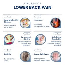 Image result for Low Back Pain Management