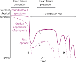 Image result for CHF Observation Unit