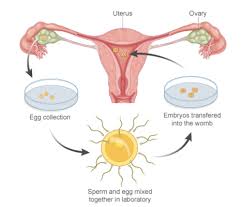In Vitro Fertilisation Ivf Mediheal Group Of Hospitals