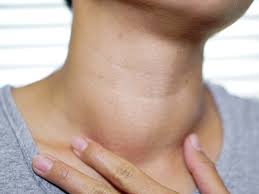 Thyroid and neck swelling evaluation