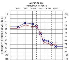 Image result for Audiogram