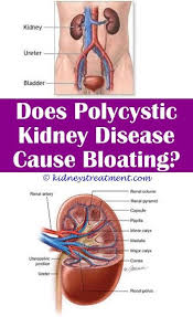 Marvelous Tips Kidney Infection Relief Kidney Care Stones Kidney Diet To Get Kidney Detox Baking In 2020 Kidney Disease Symptoms Kidney Disease Kidney Disease Recipes
