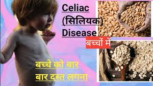 They are most common on the face (cheeks), neck, upper trunk, and upper arms of children 3 to 16 years old. White Patch On Kid S Face What Is Pityriasis Alba White Spot On Child S Face Youtube