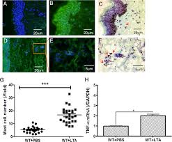 If you have any uncertainty about a mole try skinvision to get a risk assessment. A F Normal Human Skin Sections From Face Area A Dapi Staining Of The Download Scientific Diagram