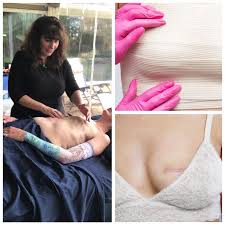 Image result for Mastectomy