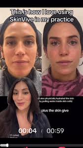 This is the one treatment I will NEVER go without!! , As part of my ANNUAL  winter “Skin Repair Process” This is my STEP 2 of the Bio-Remodel service.  , WHAT I LOVE :, •It’s SAFE• EFFECTIVE • NO ...