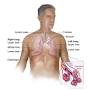small cell lung cancer lymph nodes from www.cancer.gov