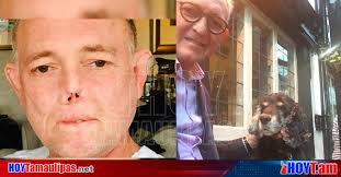 Doctor perdio sus piernas y parte de la cara por una lamida de su perro