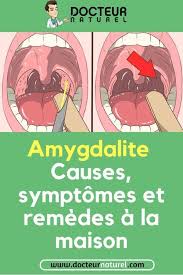 Amygdalite Causes Symptomes Et Remedes A La Maison Maux Gorge Amygdalite Remede Rhume Comic Book Cover Comic Books Book Cover