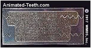 You won't have to mess with syringes of bleaching products or pay for customized dental trays. How To Use Crest Whitestrips How Long Often Are They Worn