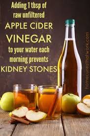 Naturally Preventing And Dissolving Kidney Stones Apple Cider Vinegar Benefits Apple Cider Vinegar Remedies Cider Vinegar
