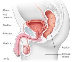 Symptoms of cancer that's spread to the bowels include: Men Red Roofs Surgery