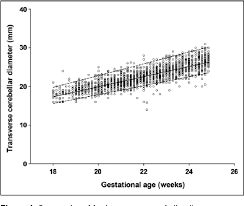 Figure 1 From Reference Range Of Fetal Transverse Cerebellar