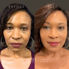 Whitney Lange, MSN, NP, CANS (@injections.by.whitney) · Richmond, VA