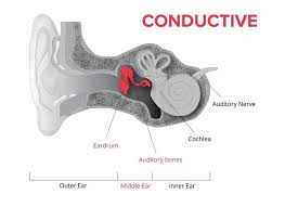Maybe you would like to learn more about one of these? Hearing Loss Information Resources Lemme Audiology