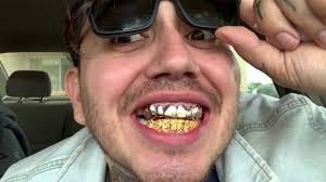 Furthermore, solid gold grillz is only intended for entertainment and cosmetic purposes and should be never be reinstated for your broken or damaged teeth. Custom Gold Grillz Review Custom Fit Solid Gold Diamond Cut With Diamond Dust Grillz Youtube