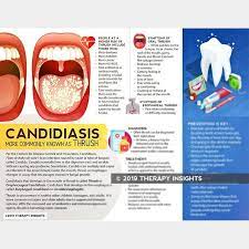 Handout Candidiasis Oral Thrush In 2021 Oral Care Oral Care Routine Oral Thrush Remedies