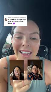 Transform Your Smile with New Teeth Now