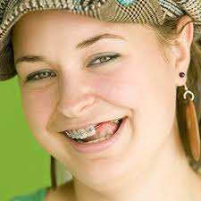 To help lessen her anxiety, girardi, then 45 years old, made a deal: Timing Is Everything When Replacing A Teenager S Missing Tooth Dr Schneider Dental Care