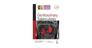 Image result for Genitourinary Tuberculosis