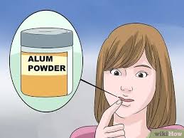 They are almost always uncomfortable, and can even be very painful while they last. 4 Ways To Treat Canker Sores Home Remedies Wikihow