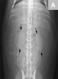 Most kidney stones eventually pass from the kidney through the ureter and bladder and finally through the urethra on their own. Imaging Of Calculi Of The Urinary System Clinician S Brief