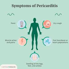 Image result for Pericarditis