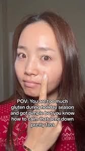 It feels like acne doesn’t want us to eat ANYTHING 😬😅 #acne #skincare  #skinpositivity #acnepositivity #skincareaddict #teamacne credits:  @skincarewithyuri