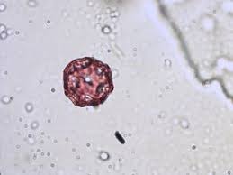 Image result for Anthospermum whyteanum