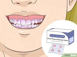 3 Manieres De Eliminer La Plaque Dentaire Wikihow