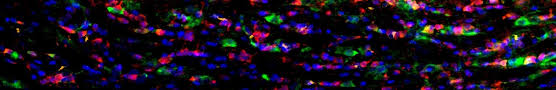 Research Publications Brain Institute Ohsu