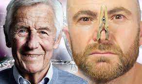 Parkinson's symptoms usually begin gradually and get worse over time. Parkinson S Disease Symptoms Signs Of The Brain Condition Include Excessive Sweating Express Co Uk