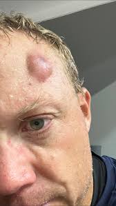 Pickleball tips for seniors to enjoy daily play