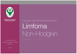 Limfoma adalah sejenis kanker darah yang dimulai dari limfosit dalam sistem limfhatik. Pnpk Limfoma Komite Penanggulangan Kanker Nasional