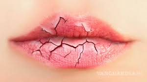 12 Razones Por Las Que Se Resecan Tus Labios Y Como Prevenirlo