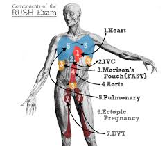 We did not find results for: Rapid Ultrasound For Shock And Hypotension Rush Gt Intensive Acute Trauma Care Group