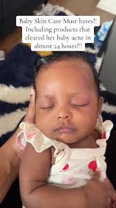 If your looking for skincare products for your baby this is a must have!!  @Mustela USA @AquaphorUS