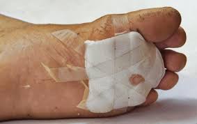 Image result for Wound Dressing