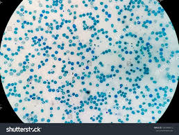 Image result for Reticulocyte Count