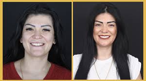 Exclusive Dental Turkey