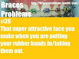 41 Braces Memes Ideas Braces Braces Humor Brace Face